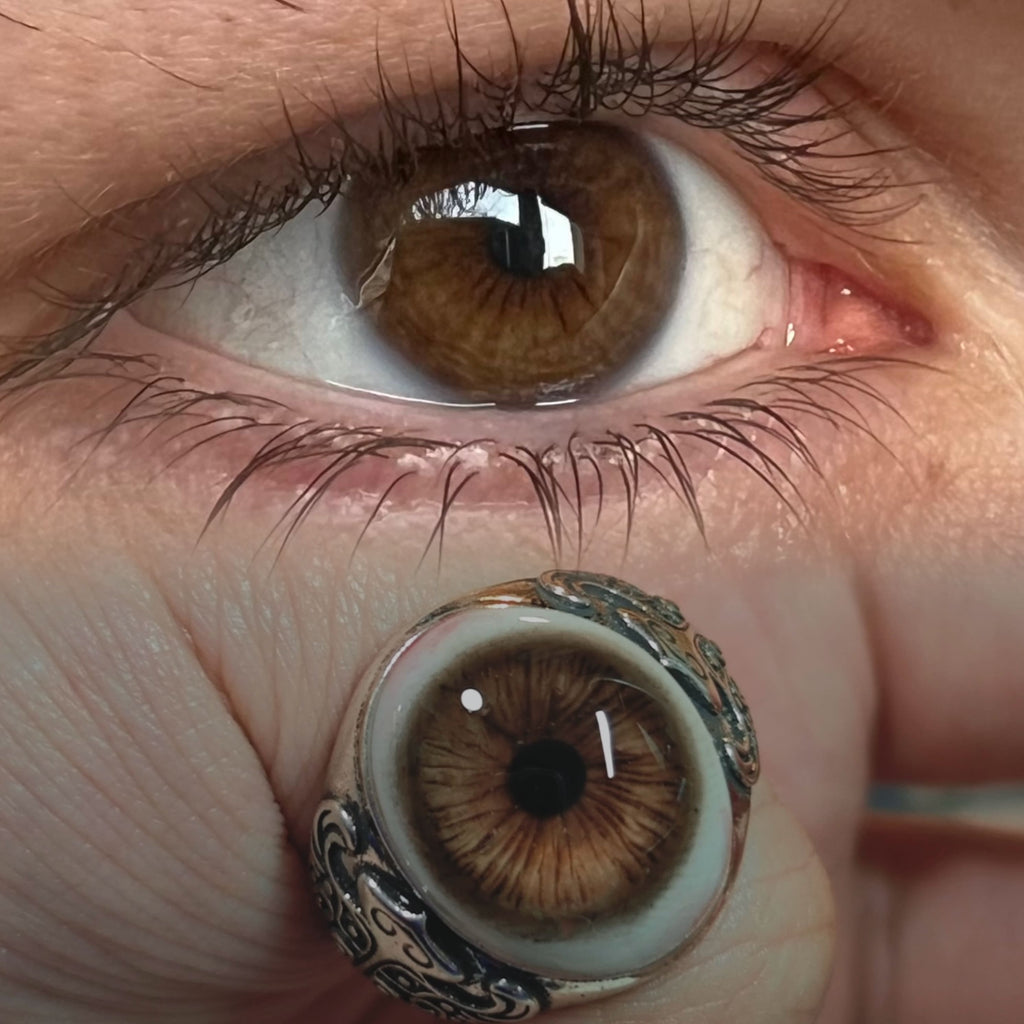 The Gaze · Sentinel Ring