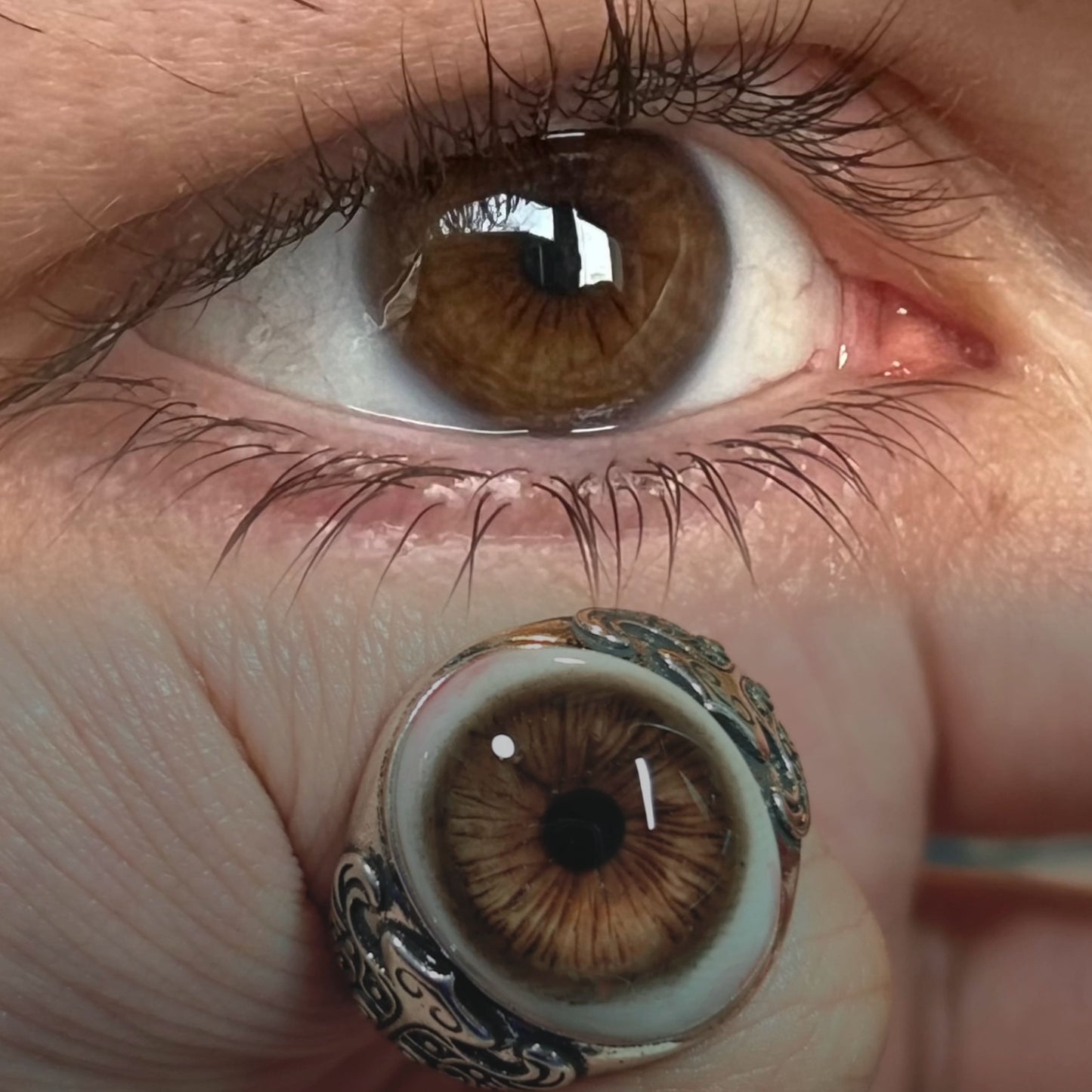 The Gaze · Sentinel Ring